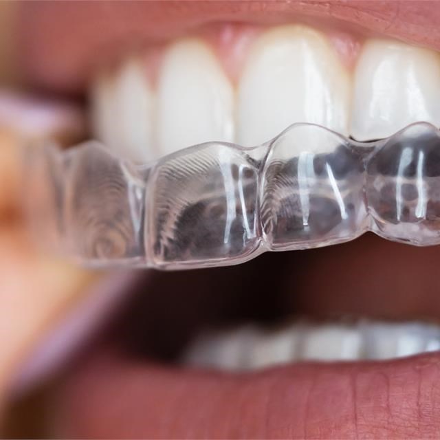 Qué es Invisalign ® y cómo funciona? Precios y resultados – Clínica dental  MADO